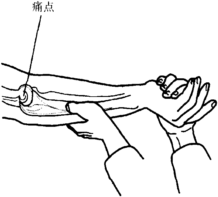 二、高爾夫球肘試驗(yàn)(肱骨內(nèi)上髁炎)